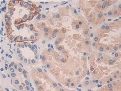 Killer Cell Immunoglobulin Like Receptor 2DL3 (KIR2DL3) Human Polyclonal Antibody