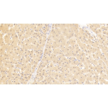 Killer Cell Immunoglobulin Like Receptor 2DL5 (KIR2DL5) Human Polyclonal Antibody