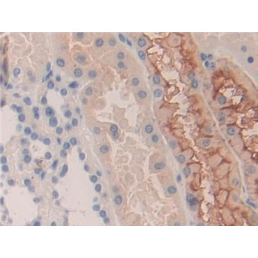 Killer Cell Immunoglobulin Like Receptor 2DS2 (KIR2DS2) Human Polyclonal Antibody