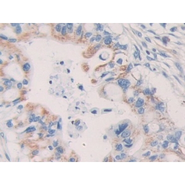 Killer Cell Immunoglobulin Like Receptor 2DL2 (KIR2DL2) Human Polyclonal Antibody