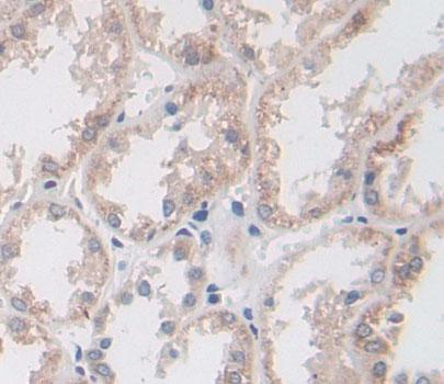 Bisphosphoglycerate Mutase (BPGM) Human Polyclonal Antibody