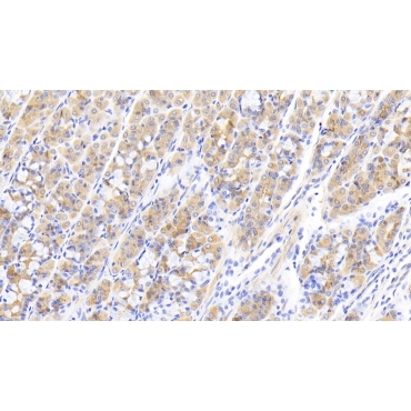 Pyruvate Dehydrogenase Phosphatase 2 (PDP2) Human Polyclonal Antibody