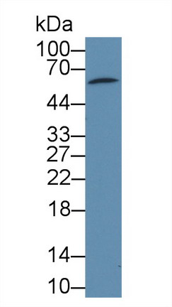 Pyruvate Dehydrogenase Phosphatase 2 (PDP2) Rat Polyclonal Antibody