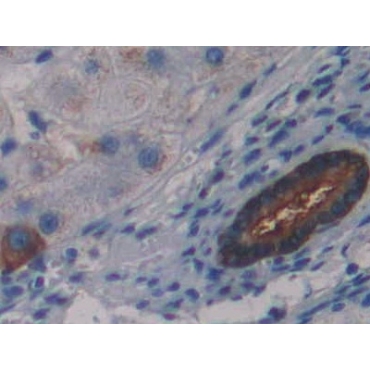 Lipolysis Stimulated Lipoprotein Receptor (LSR) Human Polyclonal Antibody