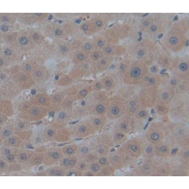 Antitrypsin Related Protein (ATR) Human Polyclonal Antibody