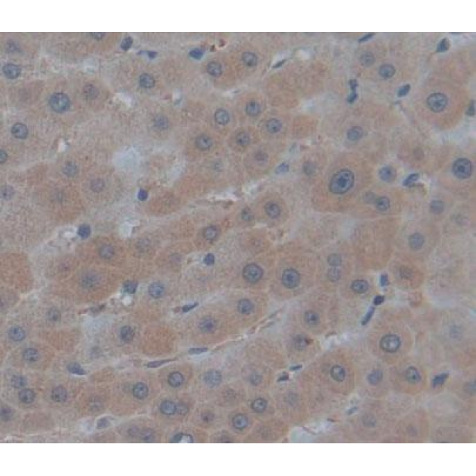 Antitrypsin Related Protein (ATR) Human Polyclonal Antibody