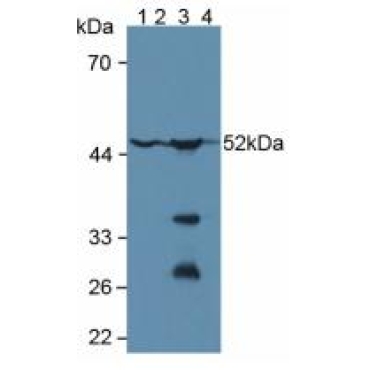 Glutathione Synthetase (GSS) Human Polyclonal Antibody