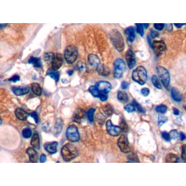 Glutathione Synthetase (GSS) Mouse Polyclonal Antibody