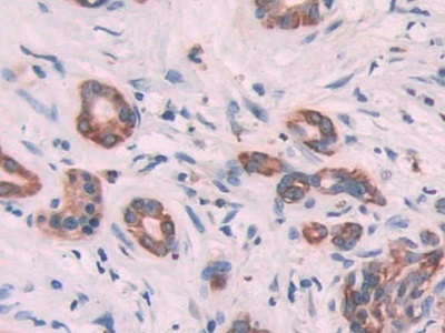 Keratin 6C (KRT6C) Human Polyclonal Antibody