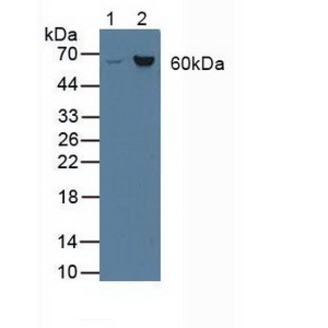 Asparagine Synthetase (ASNS) Human Polyclonal Antibody