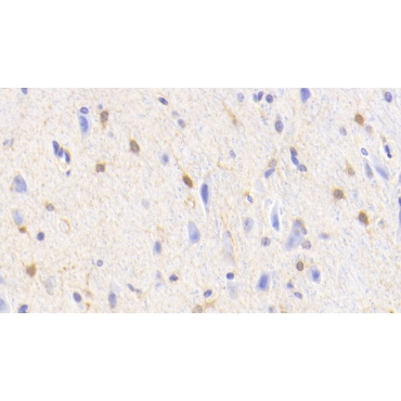 Glutamine synthetase (GS) Human Polyclonal Antibody