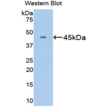 Glutamine synthetase (GS) Mouse Polyclonal Antibody