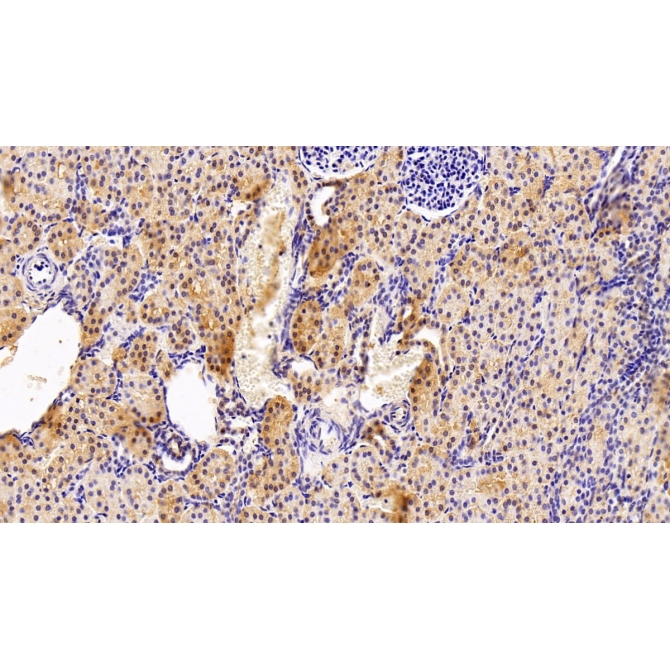 Arginine Vasopressin Induced Protein 1 (AVPI1) Human Polyclonal Antibody