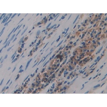 Preprovasopressin (VP) Human Polyclonal Antibody