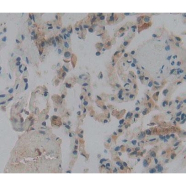Preprooxytocin (OT) Human Polyclonal Antibody