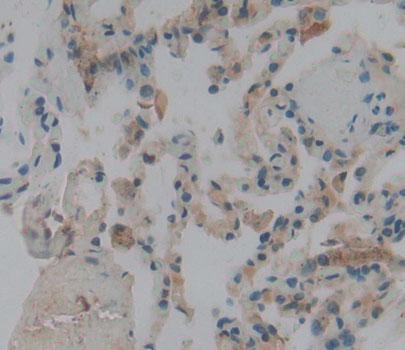 Preprooxytocin (OT) Human Polyclonal Antibody