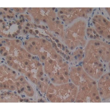 Protein Disulfide Isomerase A6 (PDIA6) Human Polyclonal Antibody