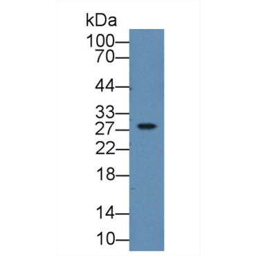 Tryptase Beta 2 (TPSb2) Human Polyclonal Antibody