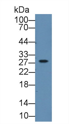 Tryptase Beta 2 (TPSb2) Human Polyclonal Antibody