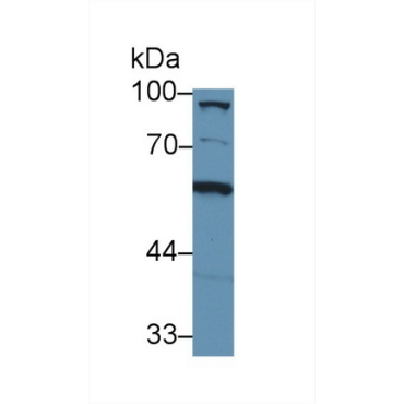 Complement Component 8a (C8a) Mouse Polyclonal Antibody