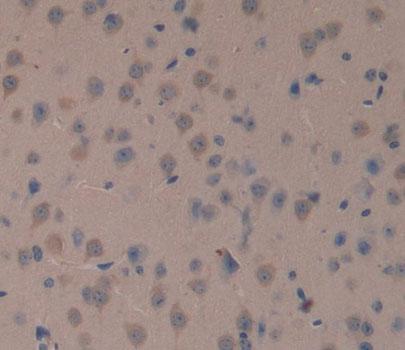 Topoisomerase I, Mitochondrial (TOP1MT) Mouse Polyclonal Antibody