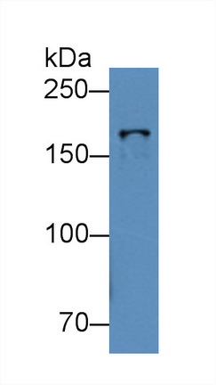 Topoisomerase II Beta (TOP2b) Mouse Polyclonal Antibody