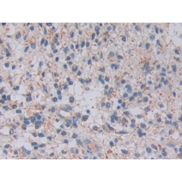Topoisomerase III (TOP3) Human Polyclonal Antibody