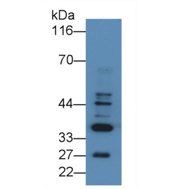 Basic Salivary Proline Rich Protein 2 (PRB2) Human Polyclonal Antibody