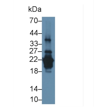 Acidic Salivary Proline Rich Phosphoprotein 2 (PRH2) Human Polyclonal Antibody