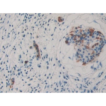 Thrombospondin 3 (THBS3) Human Polyclonal Antibody