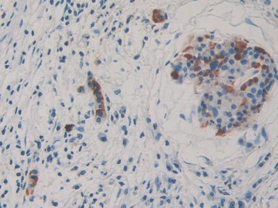 Thrombospondin 3 (THBS3) Human Polyclonal Antibody