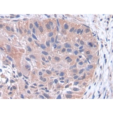 Phospholipase A2, Pancreas (pPLA2) Human Polyclonal Antibody