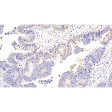 Phospholipase A2, Group III (PLA2G3) Human Polyclonal Antibody