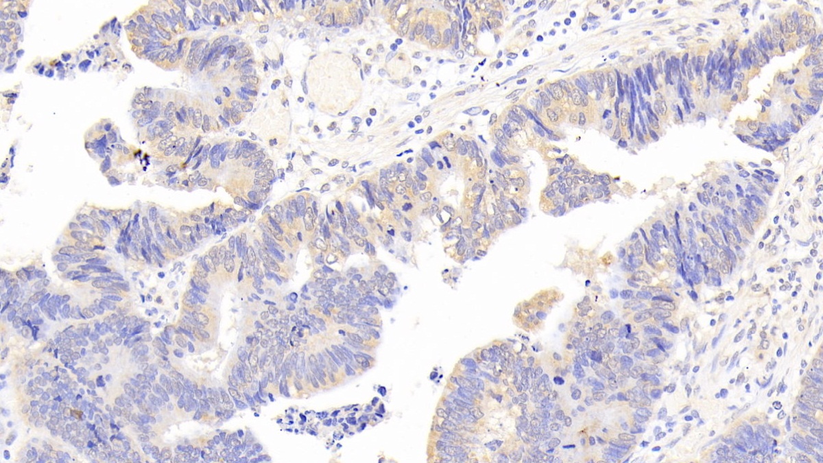 Phospholipase A2, Group III (PLA2G3) Human Polyclonal Antibody