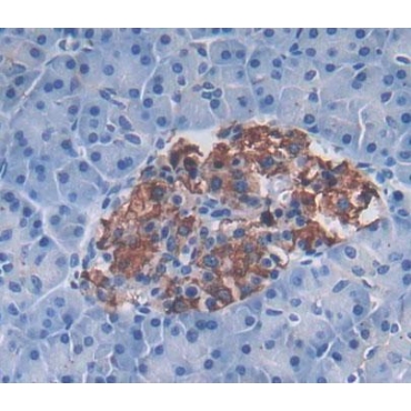 Phospholipase A2, Group XII (PLA2G12) Human Polyclonal Antibody