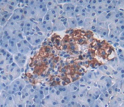 Phospholipase A2, Group XII (PLA2G12) Human Polyclonal Antibody