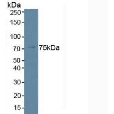 Phospholipase C Beta 2 (PLCb2) Mouse Polyclonal Antibody