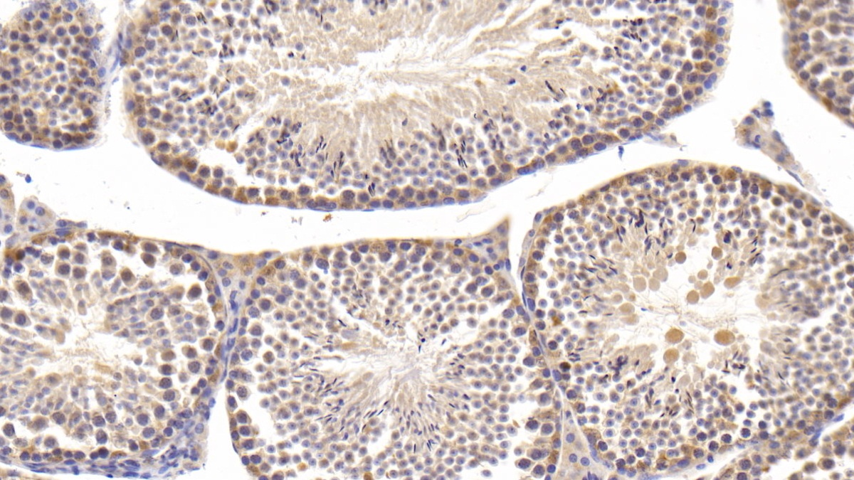 Phospholipase C Delta 1 (PLCd1) Mouse Polyclonal Antibody