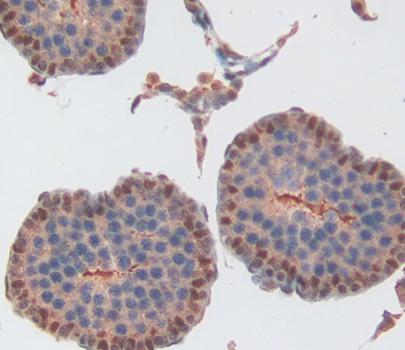 Phospholipase C Delta 4 (PLCd4) Rat Polyclonal Antibody