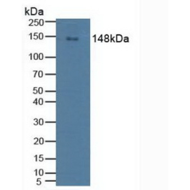 Phospholipase C Gamma 2, Phosphatidylinositol Specific (PLCg2) Human Polyclonal Antibody