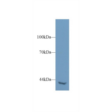 Phospholipase C Eta 2 (PLCh2) Human Polyclonal Antibody