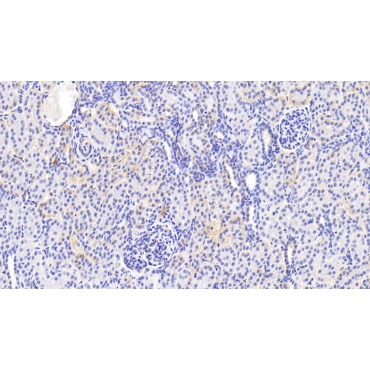 Phospholipase C Like Protein 1 (PLCL1) Human Polyclonal Antibody