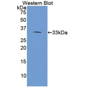 Phospholipase A2 Receptor 1 (PLA2R1) Human Polyclonal Antibody