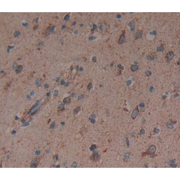 Dynamin 3 (DNM3) Human Polyclonal Antibody