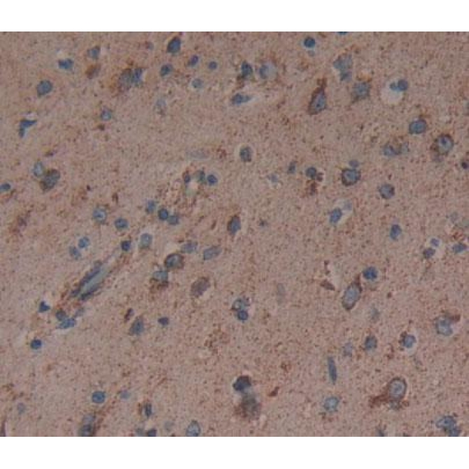 Dynamin 3 (DNM3) Human Polyclonal Antibody