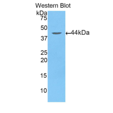 Aspartate Aminotransferase 2 (AST2) Human Polyclonal Antibody