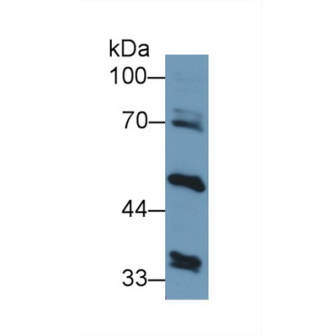 Alanine Aminotransferase 2 (ALT2) Human Polyclonal Antibody