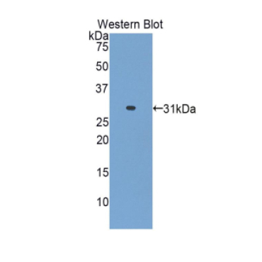 Alanine Aminotransferase 2 (ALT2) Mouse Polyclonal Antibody