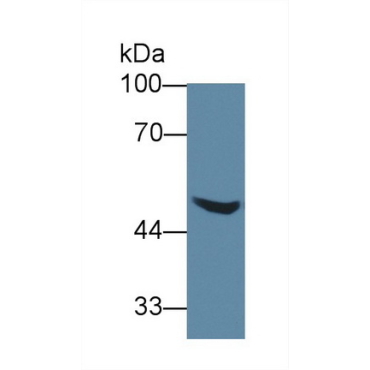 Alanine Glyoxylate Aminotransferase 2 (AGXT2) Human Polyclonal Antibody