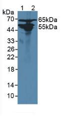 Alanine Glyoxylate Aminotransferase 2 (AGXT2) Rat Polyclonal Antibody